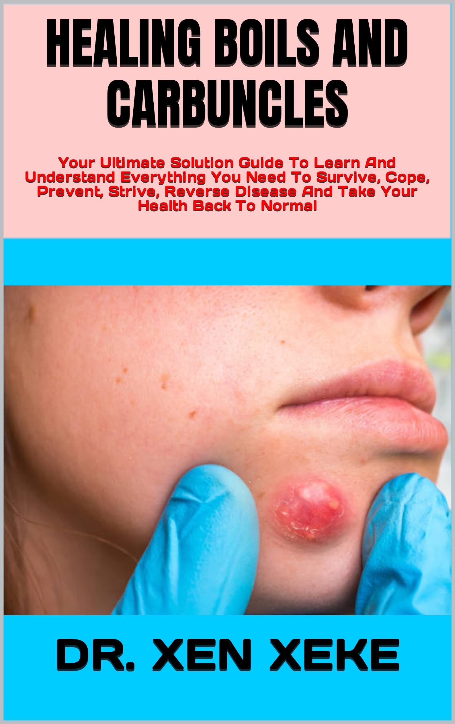 HEALING BOILS AND CARBUNCLES Your Ultimate Solution Guide To Learn