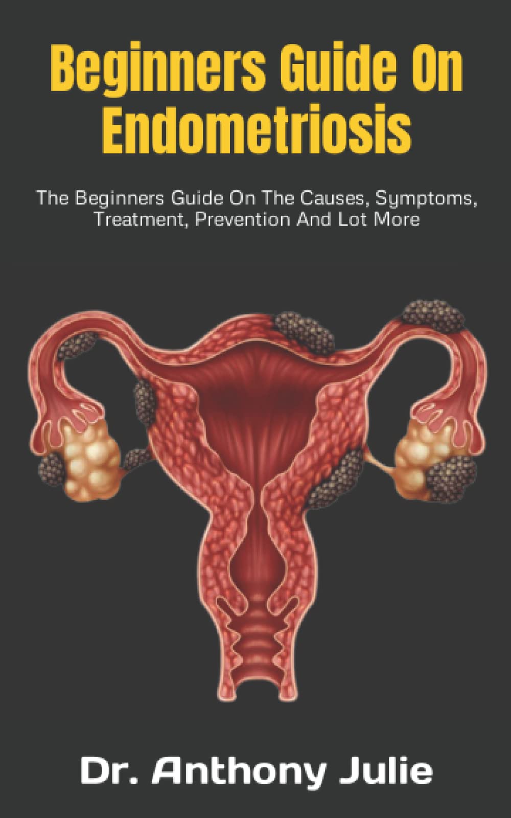 Beginners Guide On Endometriosis The Beginners Guide On The Causes