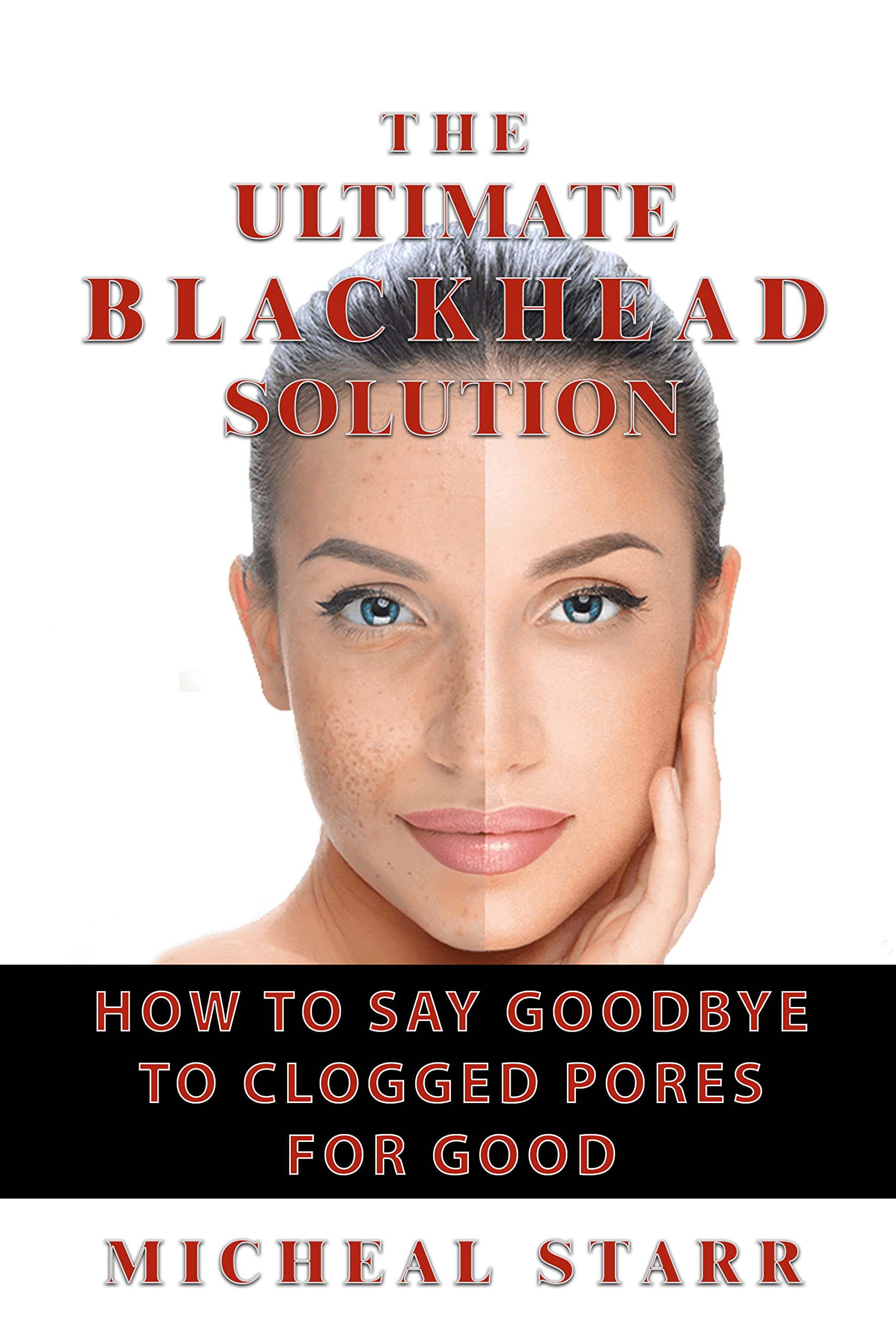 Say Goodbye To Big Blackheads With These Expert Tips - gh7kym0