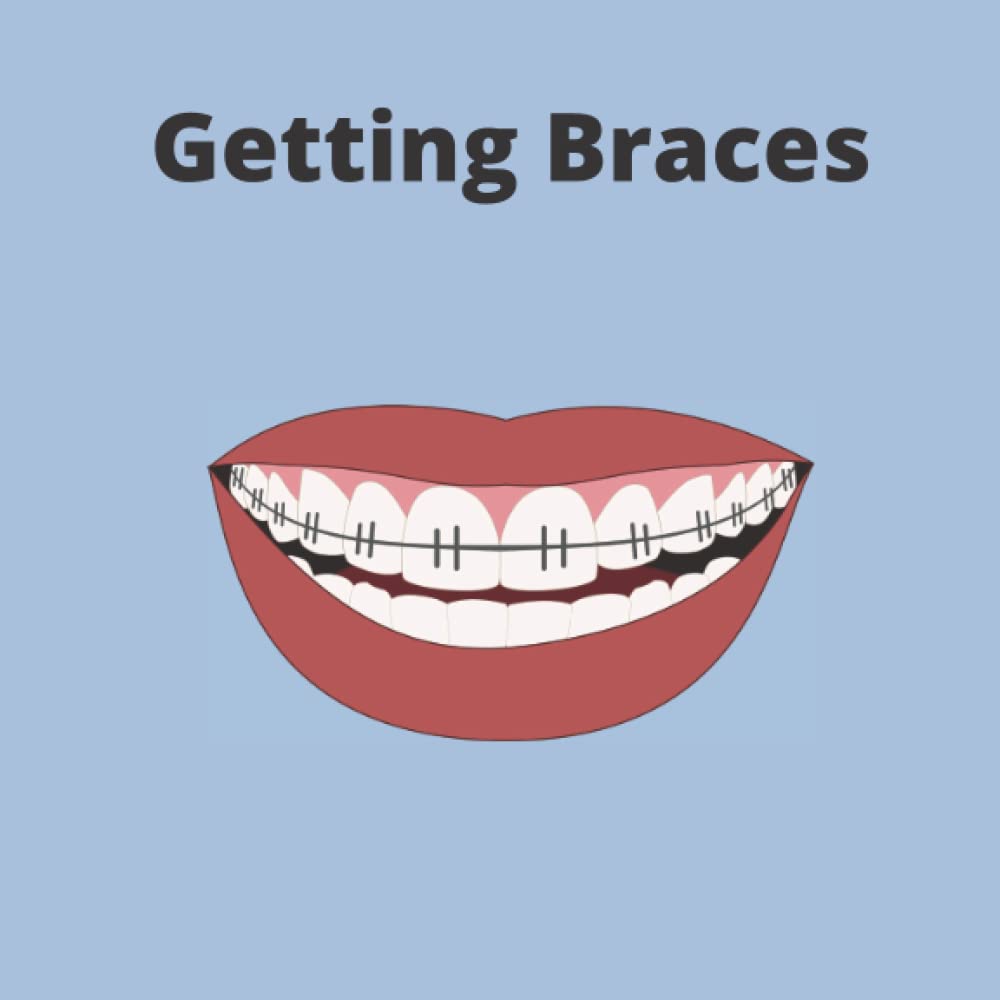 Getting Braces by Heather McKay Goodreads