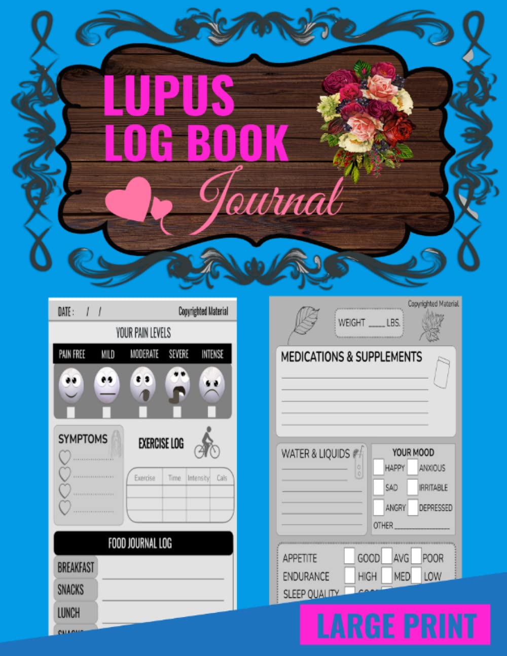 Lupus Log Book journal Keep Track of Your Lupus Disease Symptoms, Pain