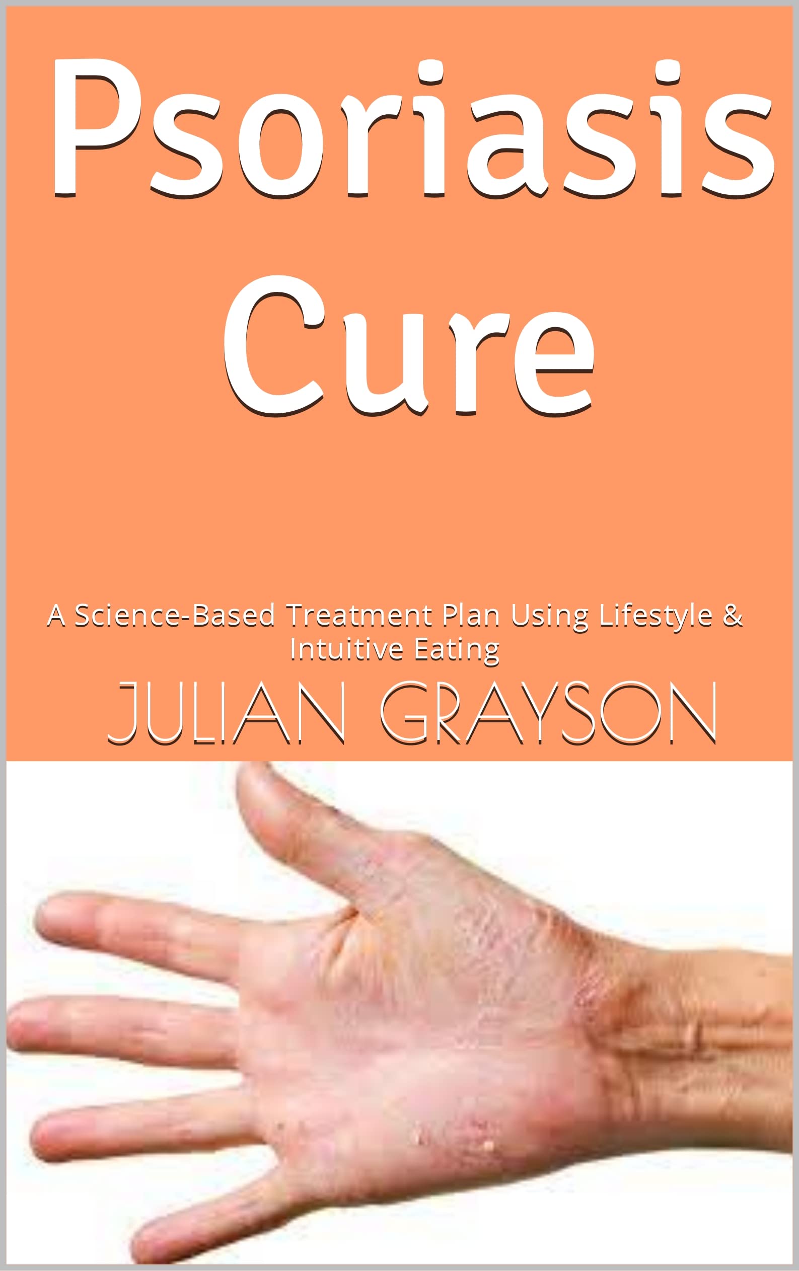 Psoriasis Cure A ScienceBased Treatment Plan Using Lifestyle