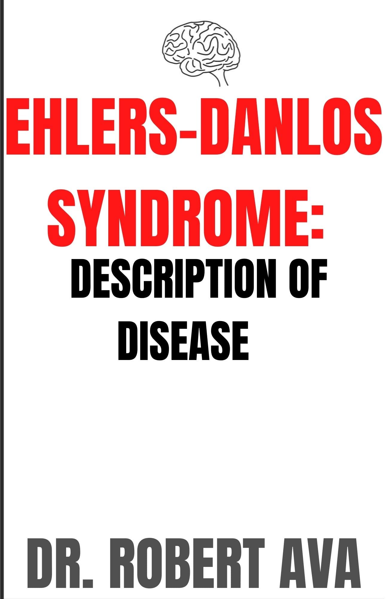 EHLERSDANLOS SYNDROME DESCRIPTION OF DISEASE by DR. ROBERT AVA