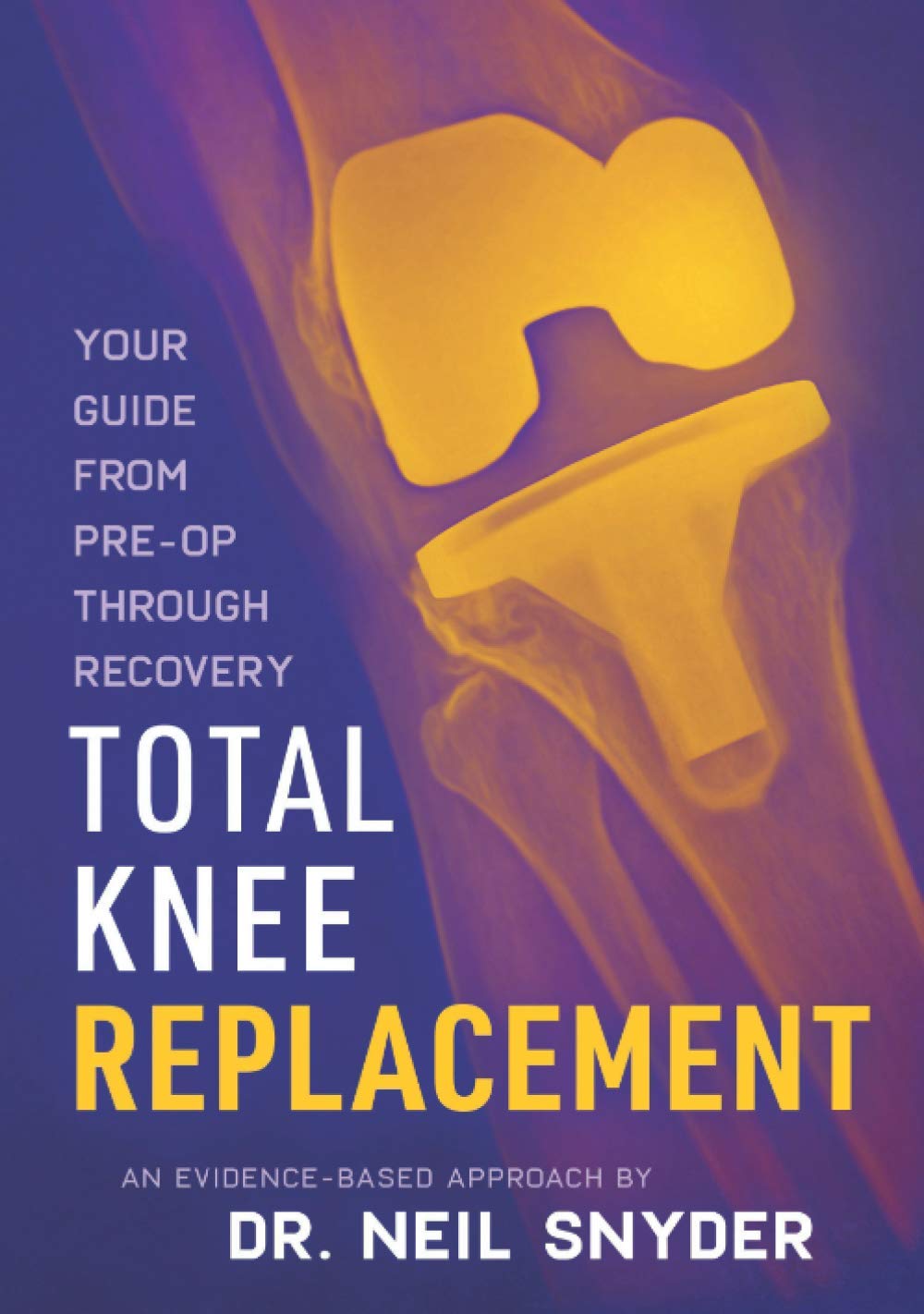 total-knee-replacement-your-guide-from-pre-op-through-recovery-by-dr