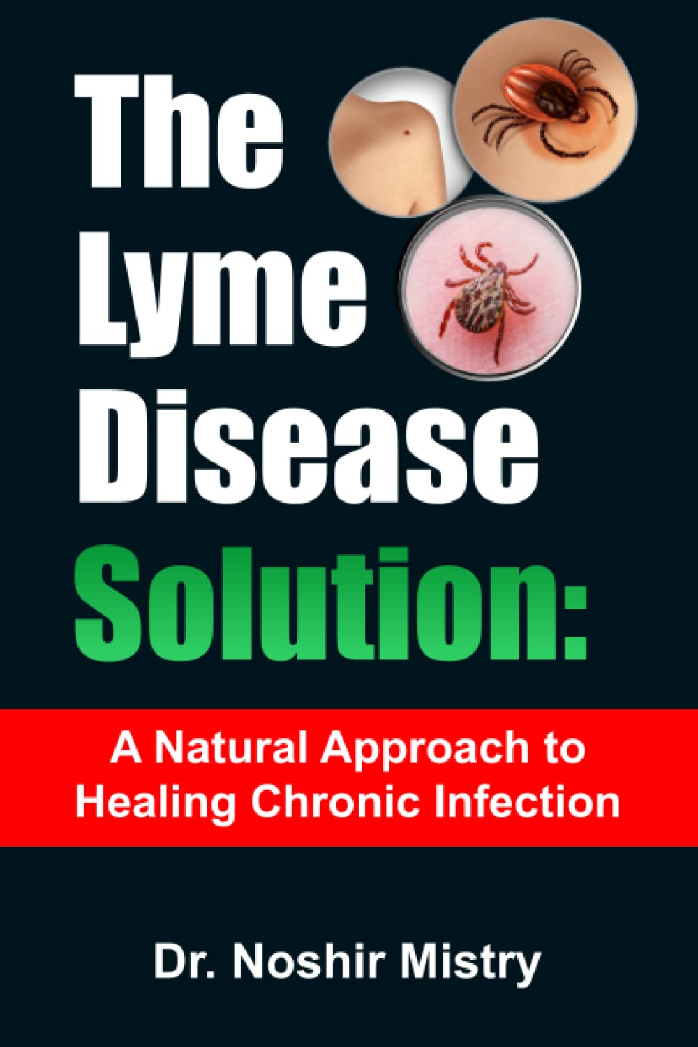 The Lyme Disease Solution A Natural Approach to Healing Chronic Infection by Dr. Noshir Mistry