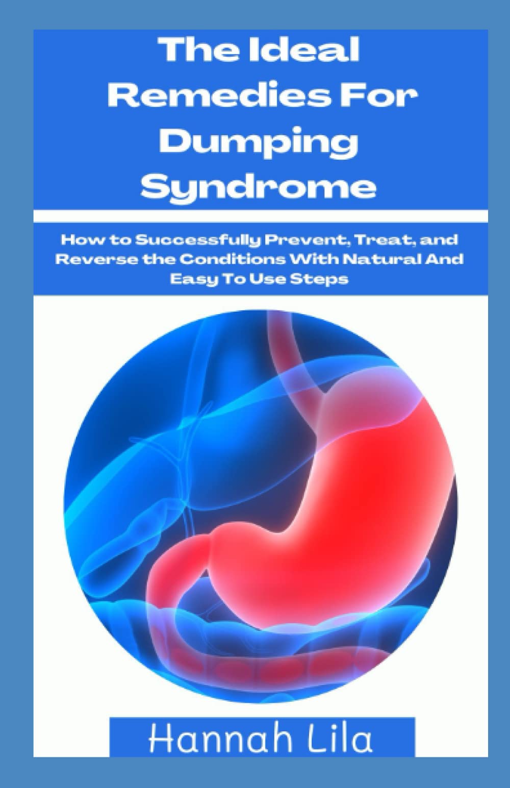 The Ideal Remedies For Dumping Syndrome How to Successfully Prevent