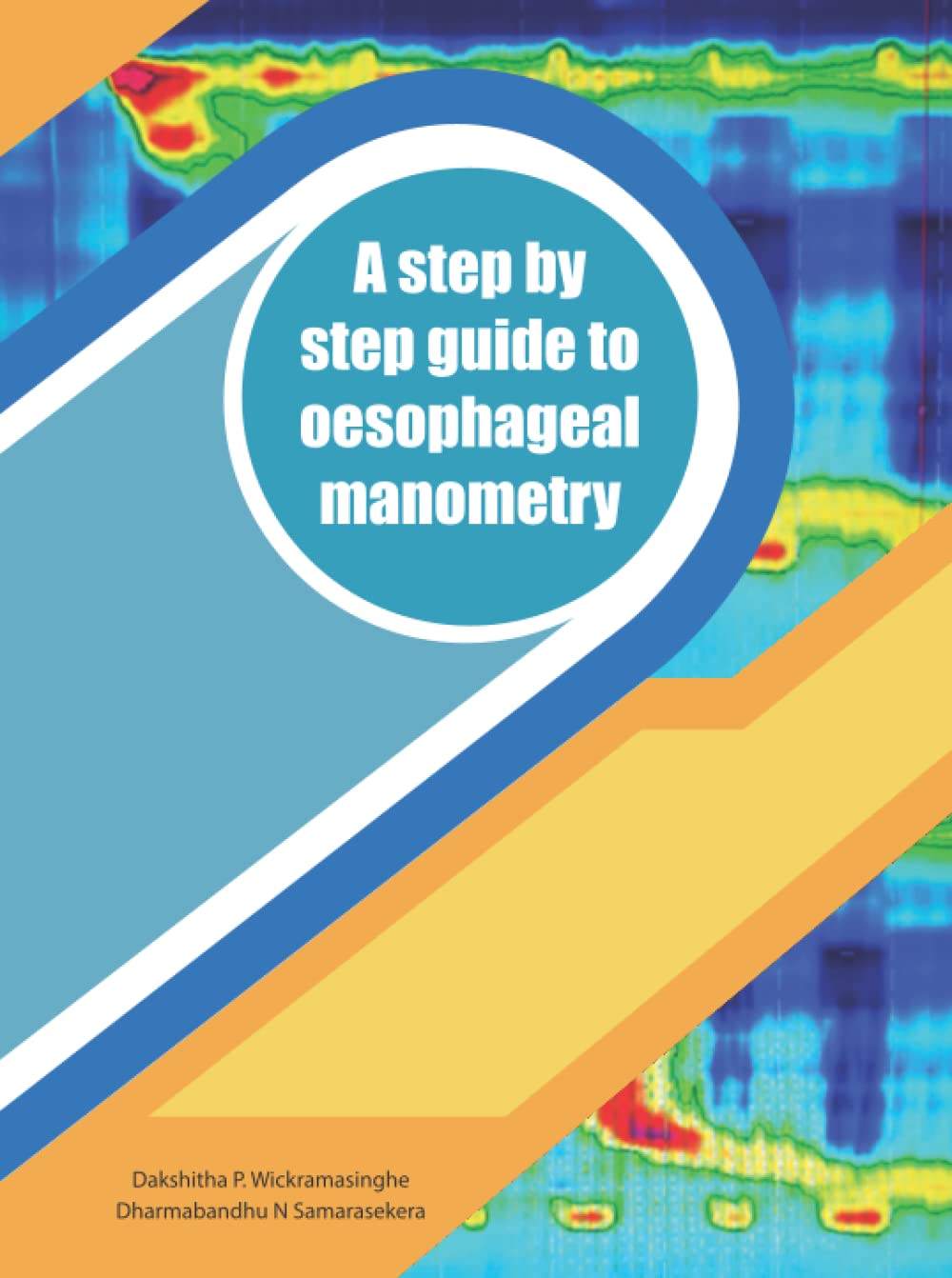 A step by step guide to oesophageal manometry A laboratory manual for