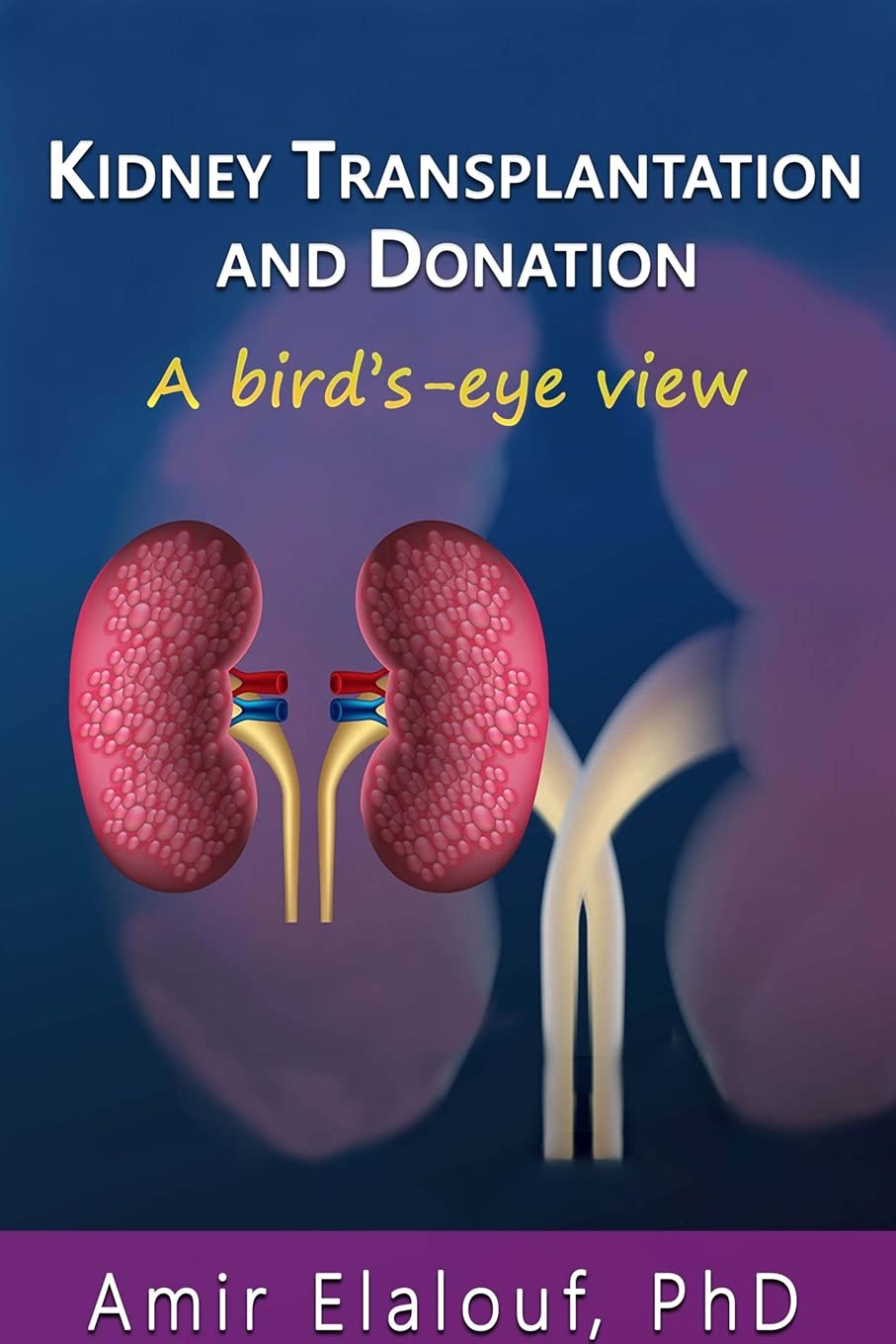 Kidney Transplantation and Donation A Bird'sEye View by Amir Elalouf