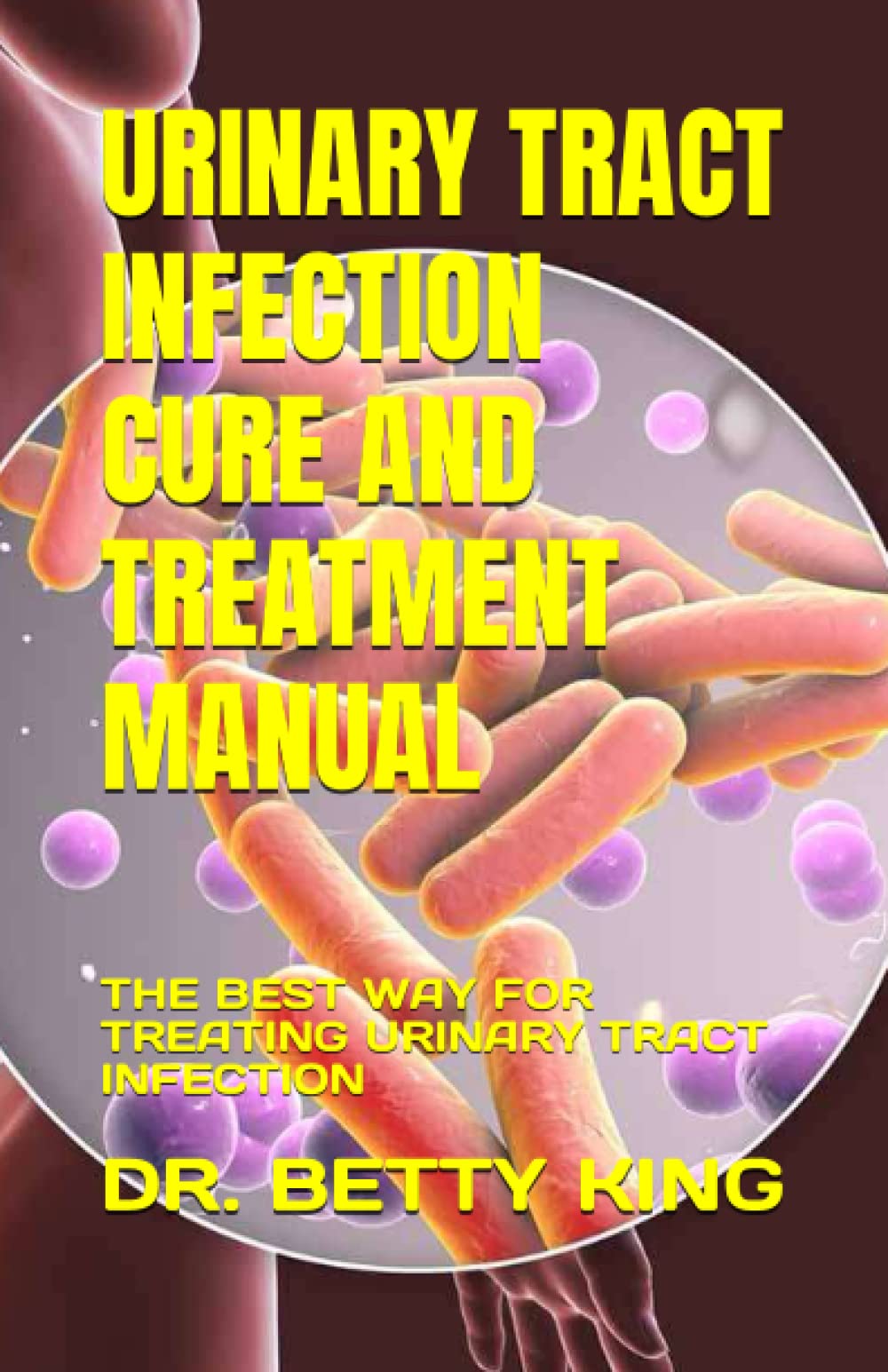 URINARY TRACT INFECTION CURE AND TREATMENT MANUAL THE BEST WAY FOR