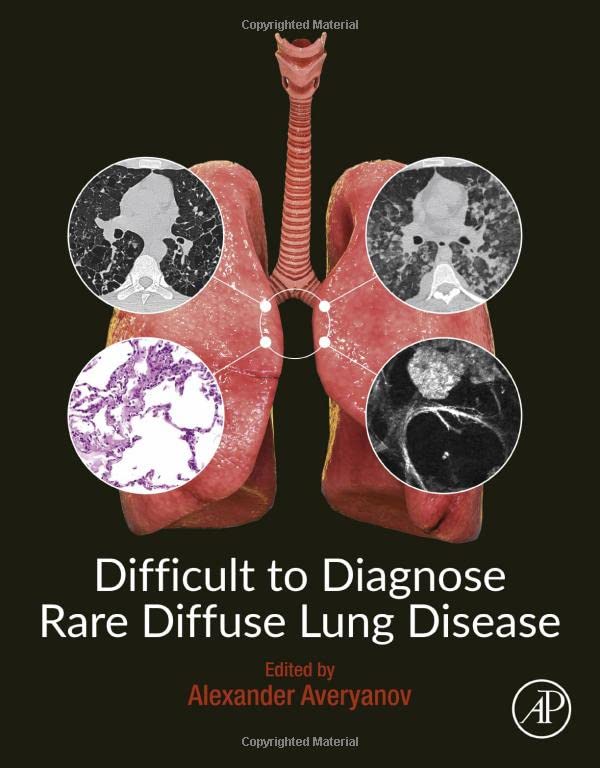 Difficult to Diagnose Rare Diffuse Lung Disease by Alexander V