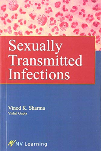 Sexually Transmitted Infections by Vinod K. Sharma | Goodreads