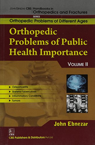 John Ebnezar CBS Handbooks in Orthopedics and Factures Orthopedic