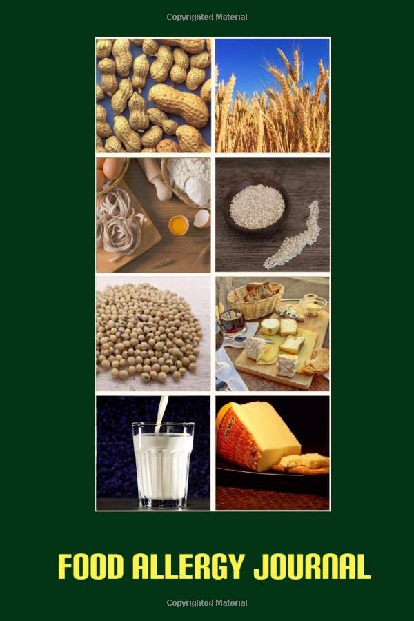 Food Allergy Journal Food Journal for People with Food Sensitivity. Daily Journal to Track