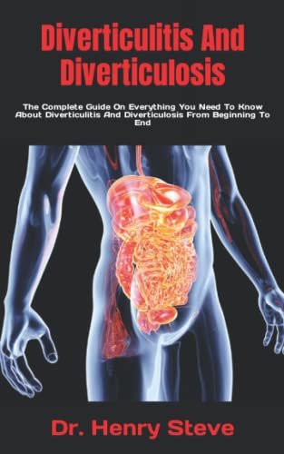 Diverticulitis And Diverticulosis: The Complete Guide On Everything You