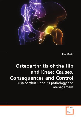 Osteoarthritis of the Hip and Knee: Causes, Consequences and Control ...