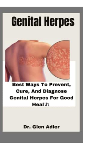 Genital Herpes: Best Way To Prevent, Cure, And Diagnose Genital Herpes ...