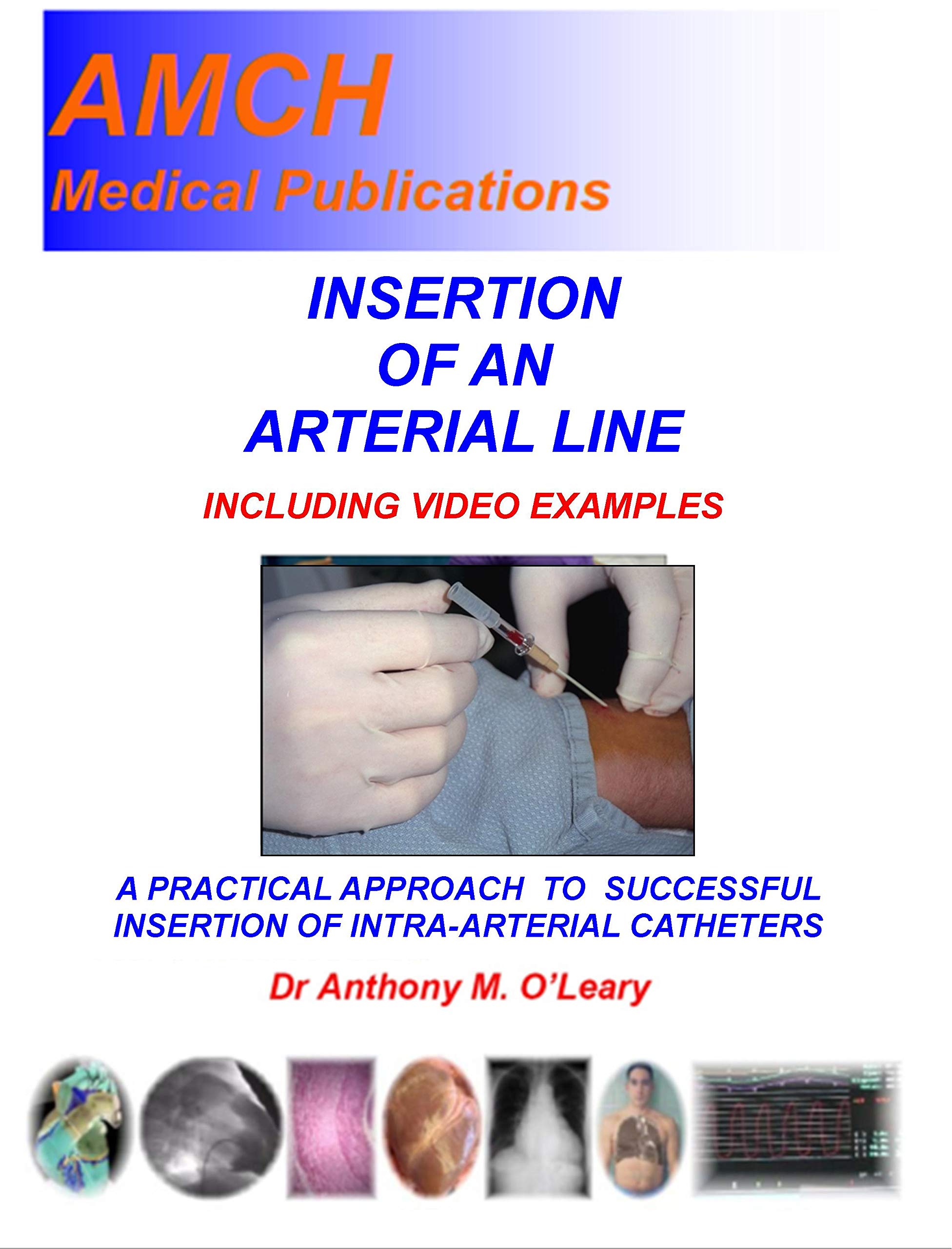 INSERTION OF AN ARTERIAL LINE A practical approach to successful