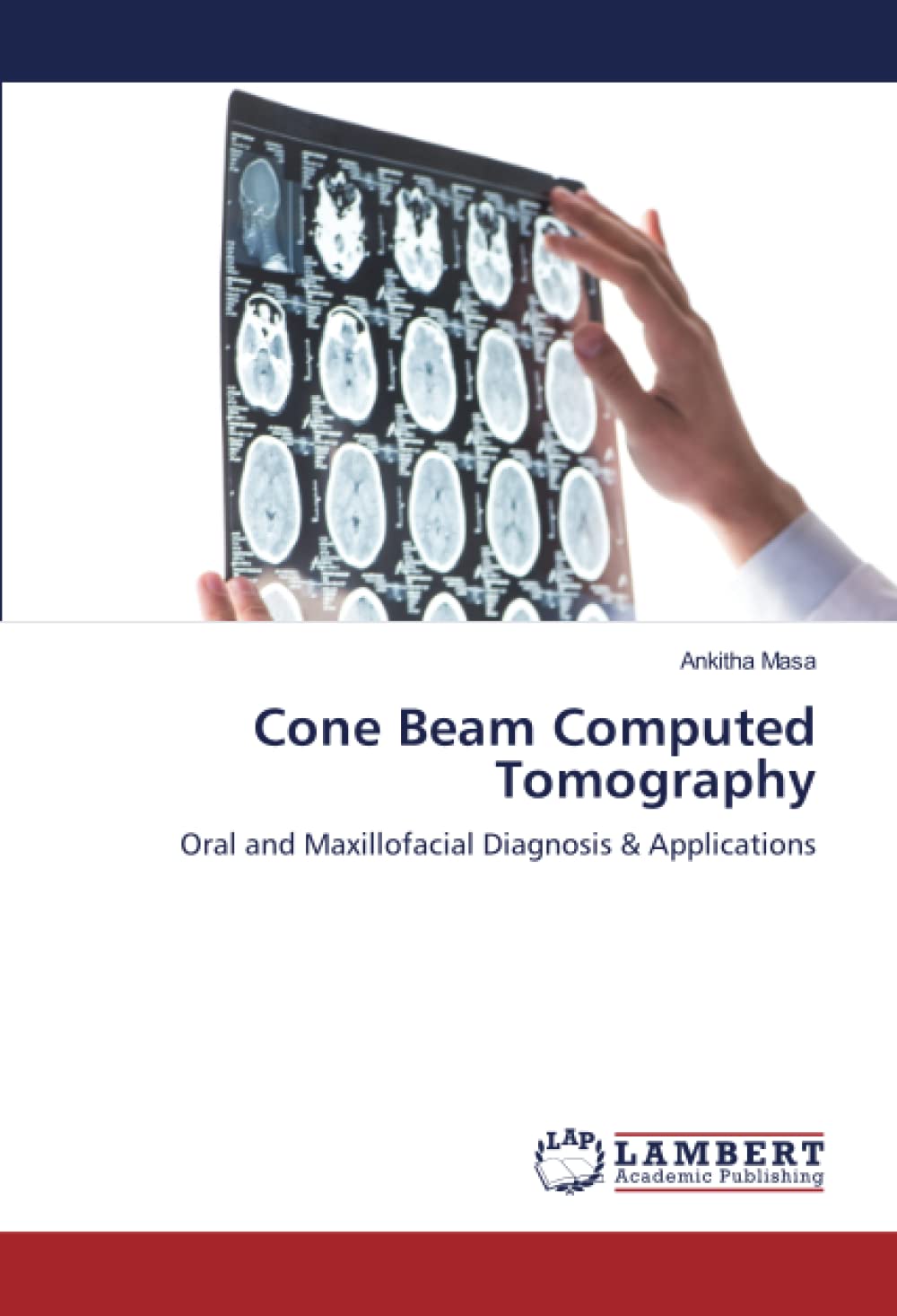 Cone Beam Computed Tomography In Endodontics Morita vrogue.co