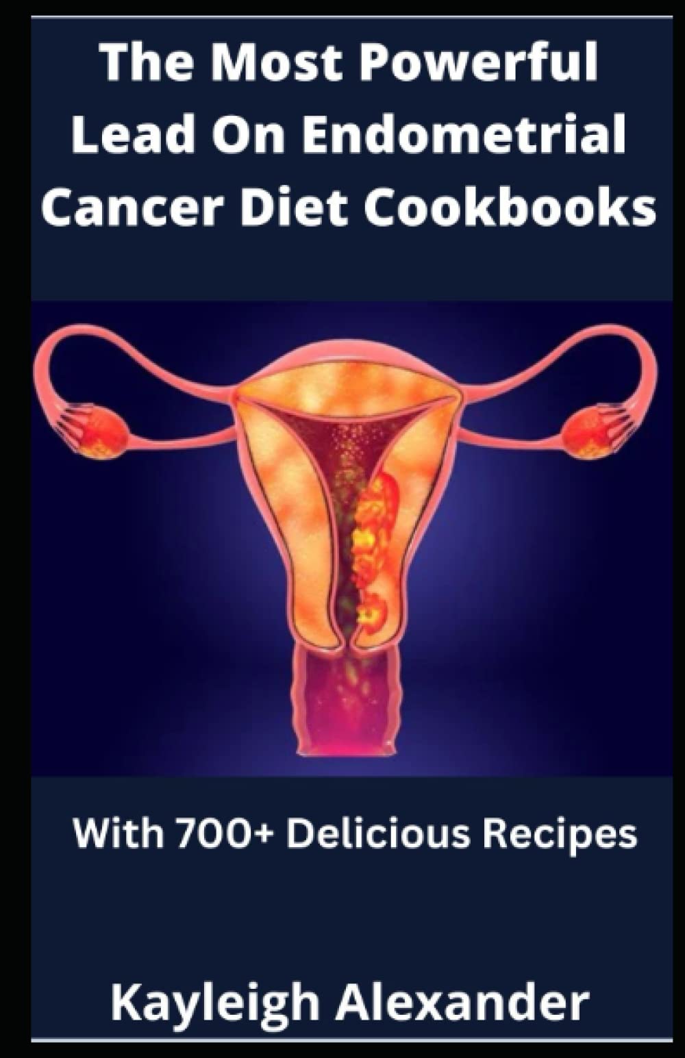 The Most Powerful Lead On Endometrial Cancer Diet Cookbooks With 700
