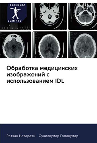 Обработка медицинских изображений с использованием IDL by Ратхан ...