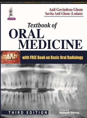 Textbook of Oral Medicine + Basic Oral Radiology by Mahesh Verma ...