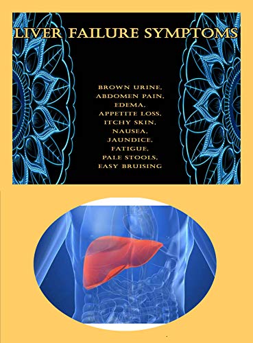 Liver Failure Symptoms: Brown Urine, Abdomen Pain, Edema, Appetite Loss
