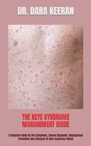 THE REYE SYNDROME MANAGEMENT GUIDE A Complete Guide On The Symptoms