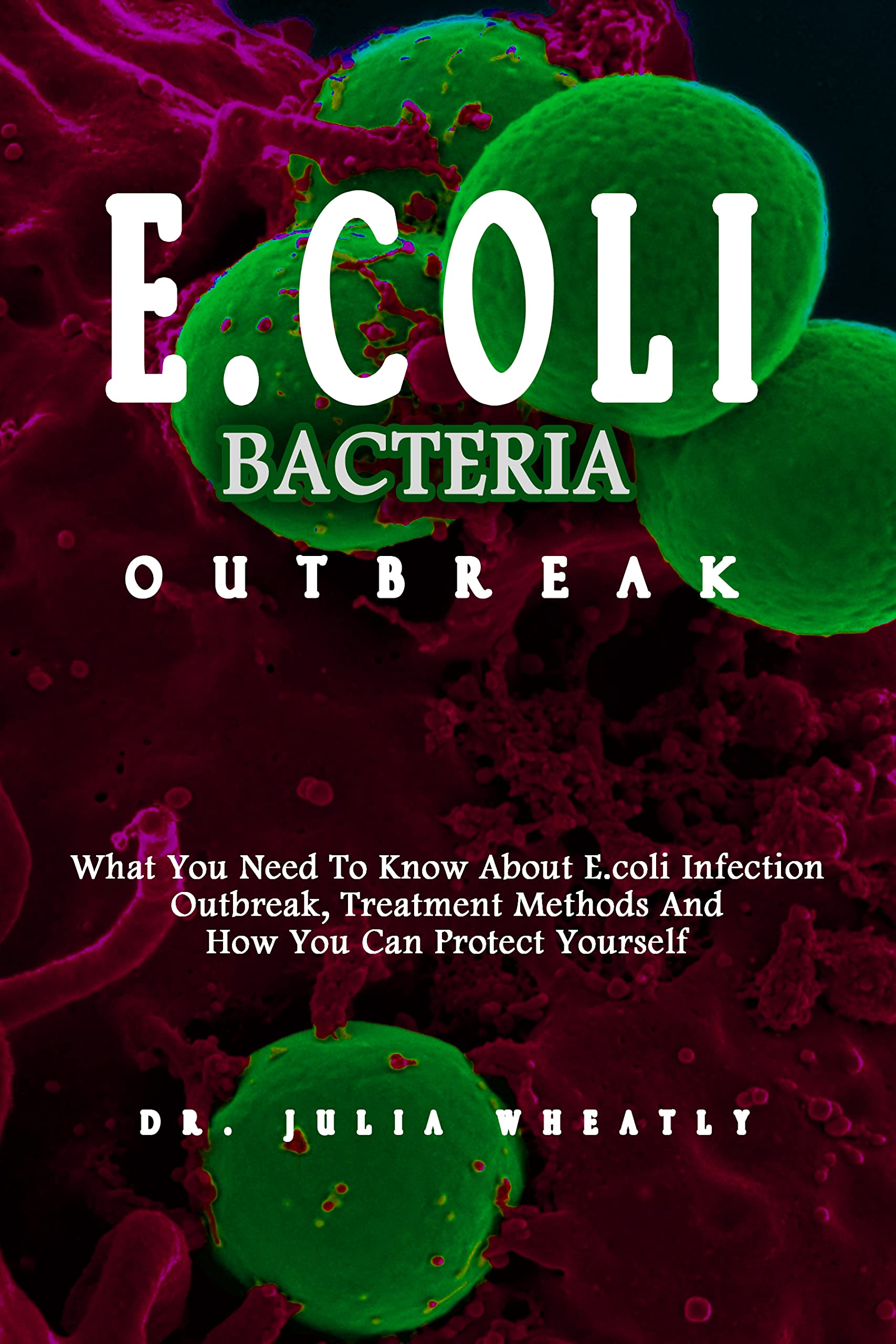 E.coli Bacteria Outbreak What You Need To Know About E.coli Infection