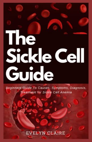 THE SICKLE CELL GUIDE: Beginners Guide To Causes, Symptoms, Diagnosis ...