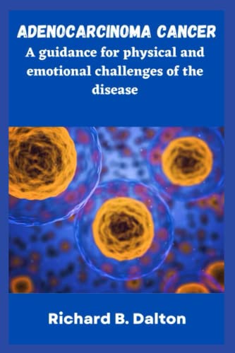 Adenocarcinoma cancer: A guidance for physical and emotional challenges ...
