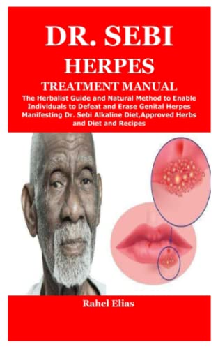 Dr. Sebi Herpes Treatment Manual: The Herbalist Guide and Natural ...