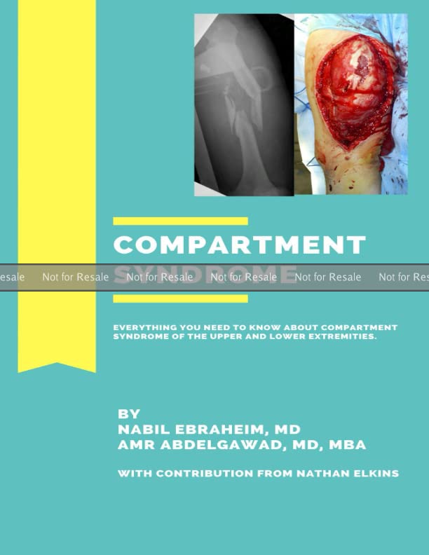 PROOF Compartment Syndrome Everything you need to know about