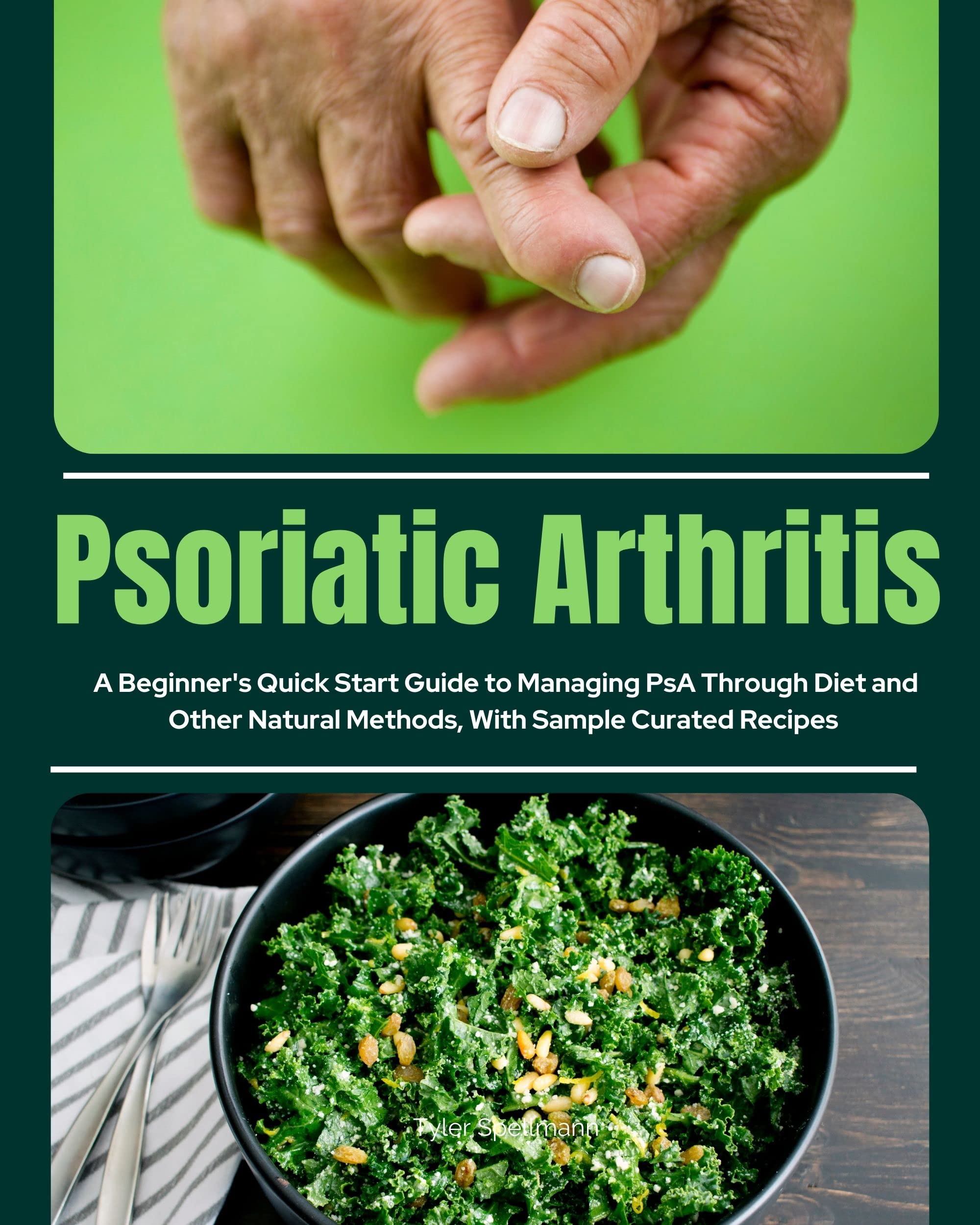 Psoriatic Arthritis A Beginner's Quick Start Guide to Managing PsA