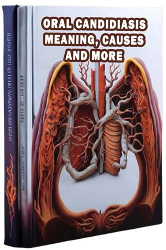 Oral Candidiasis Meaning, Causes and More: Understand oral candidiasis