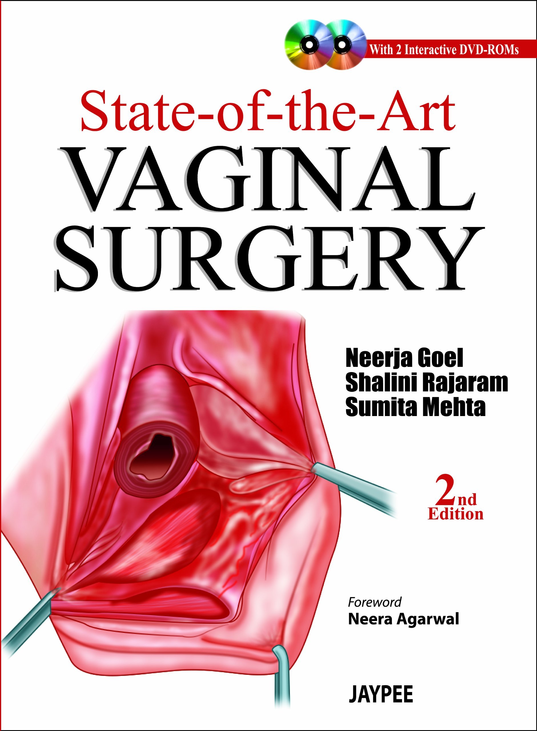 State-Of-The-Art Vaginal Surgery