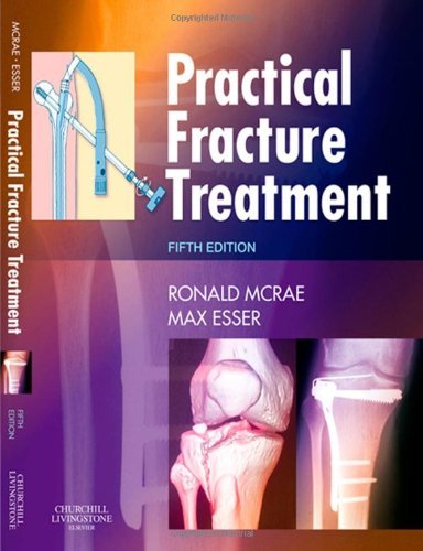 Practical Fracture Treatment 5e