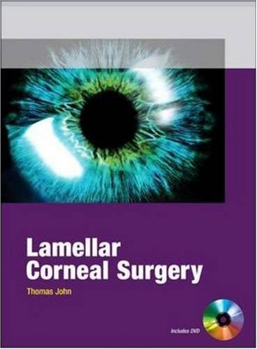 Lamellar Corneal Surgery