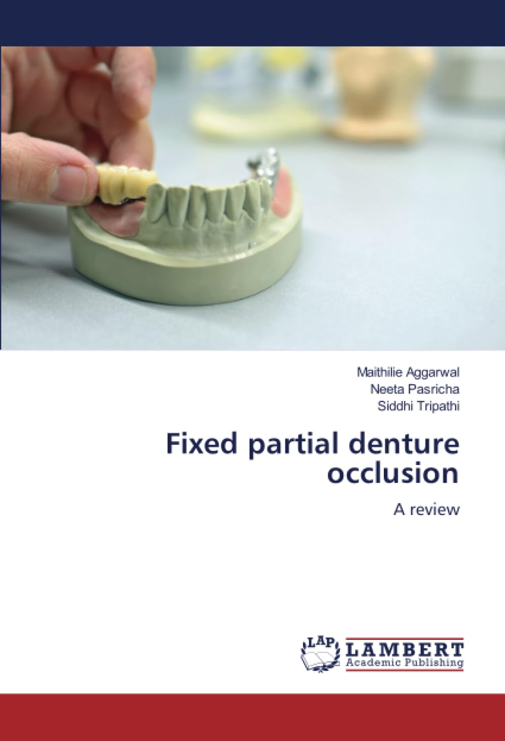 Fixed partial denture occlusion A review by Maithilie Aggarwal Goodreads