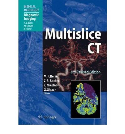 Multislice CT