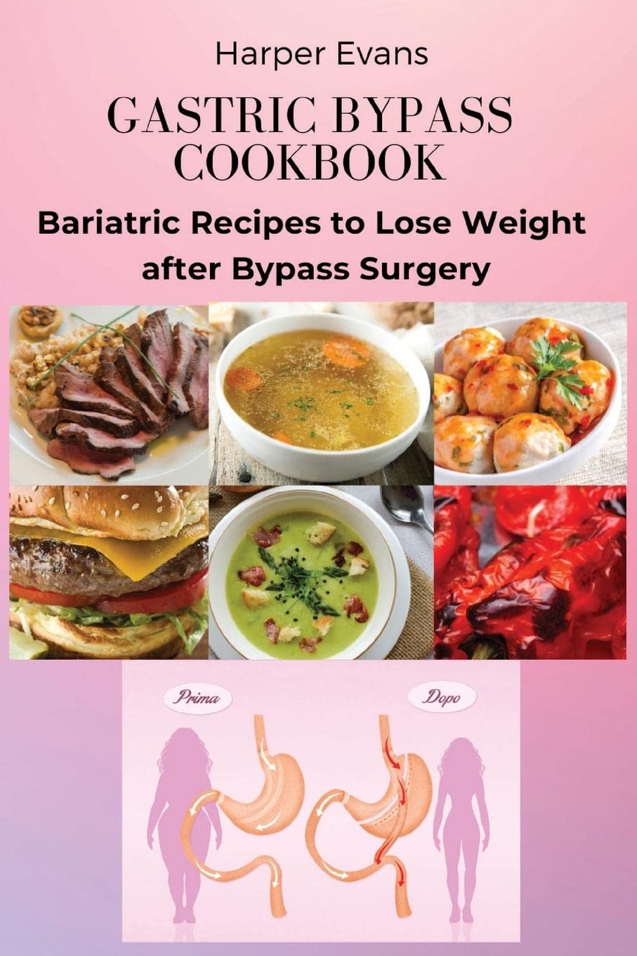 Gastric Bypass Cookbook Bariatric Recipes to Lose Weight after Bypass