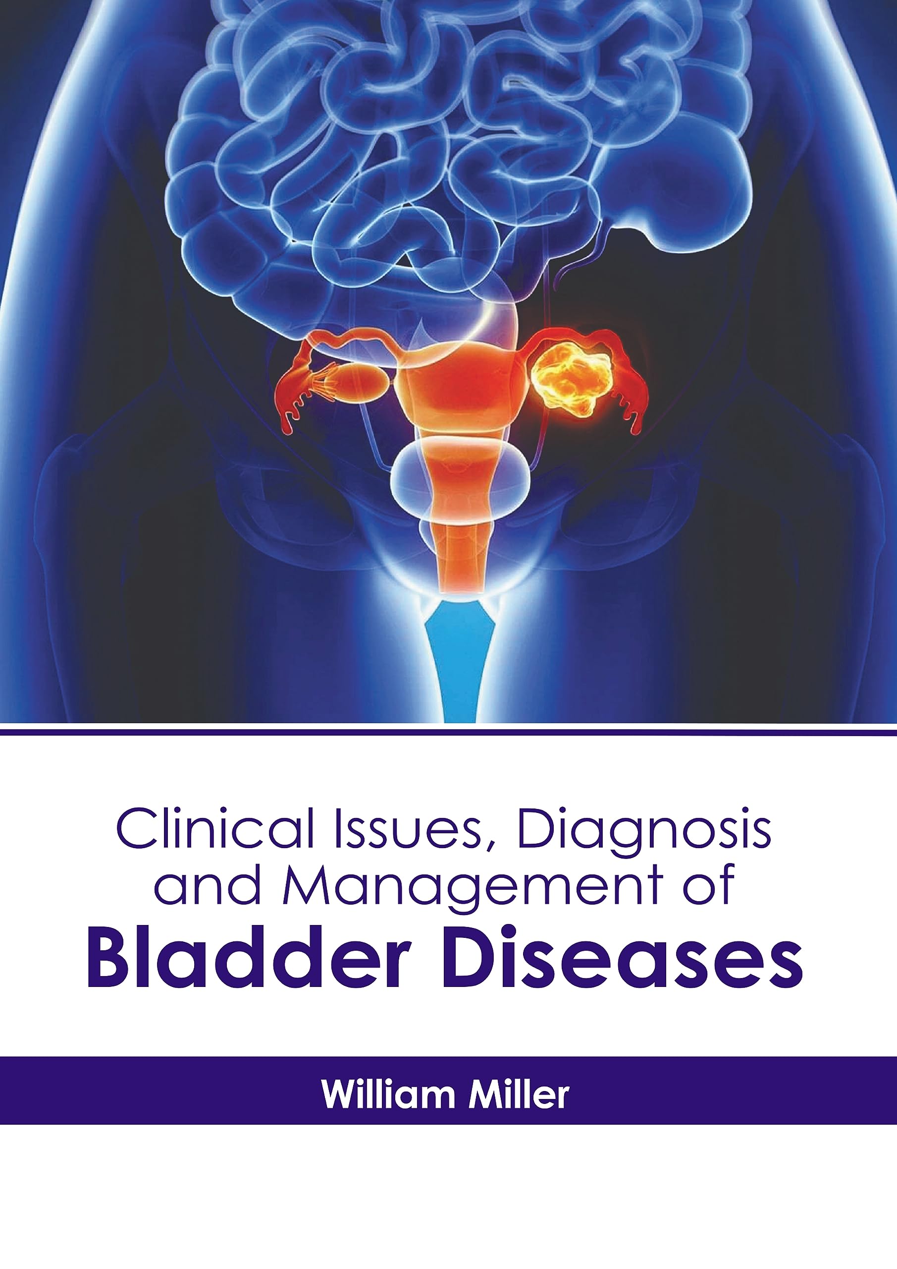 Clinical Issues, Diagnosis and Management of Bladder Diseases by