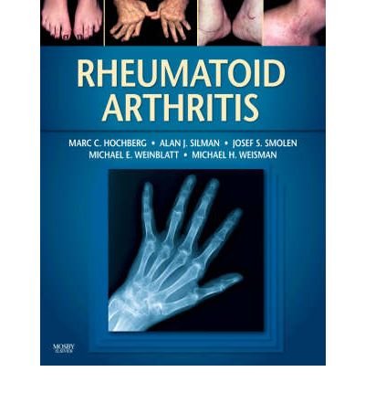 Rheumatoid Arthritis **