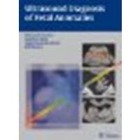 Ultrasound of Fetal Anomalies
