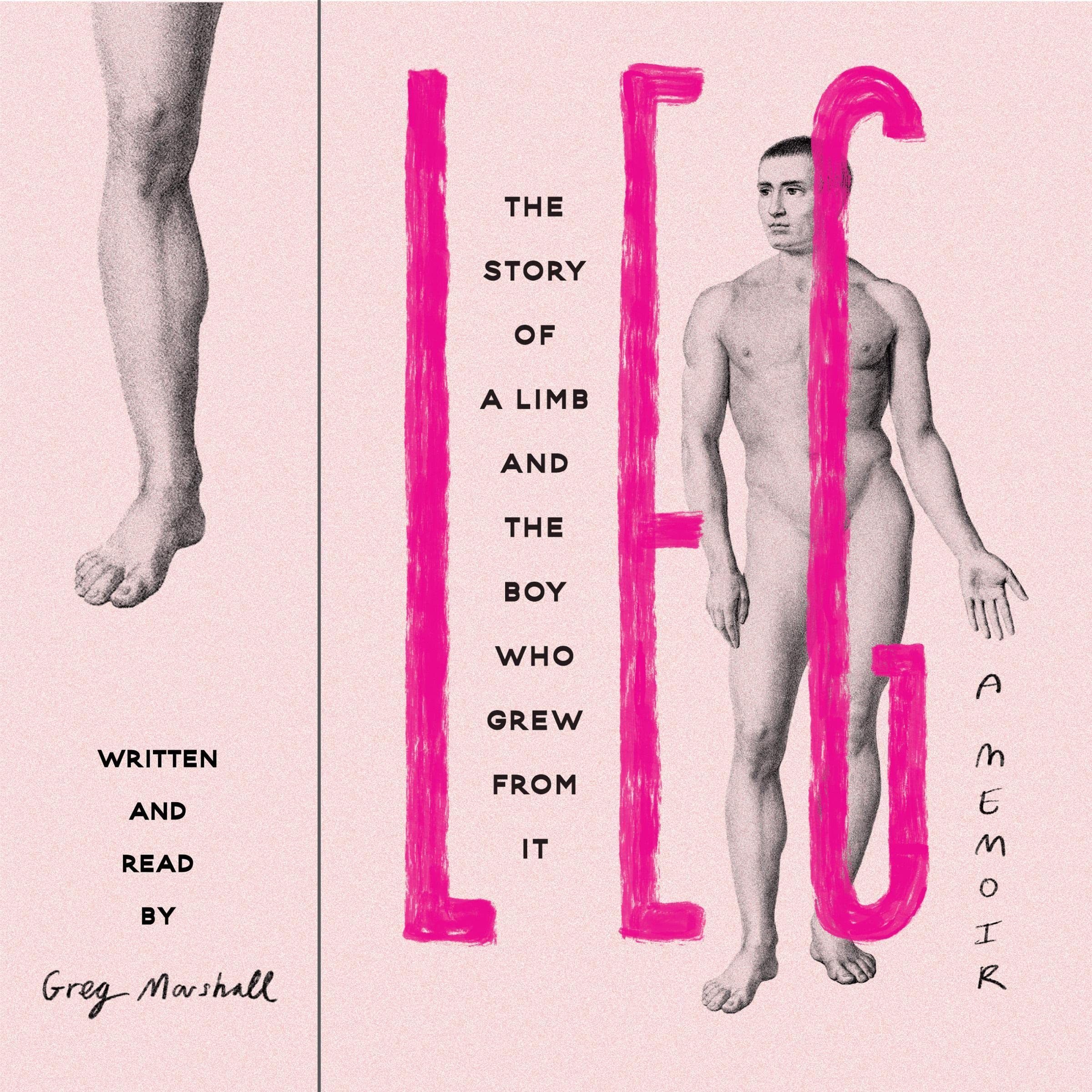 Leg: The Story of a Limb and the Boy Who Grew from It