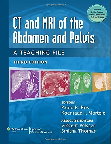 (CT & MRI of the Abdomen and Pelvis: A Teaching File (LWW Teaching File ...