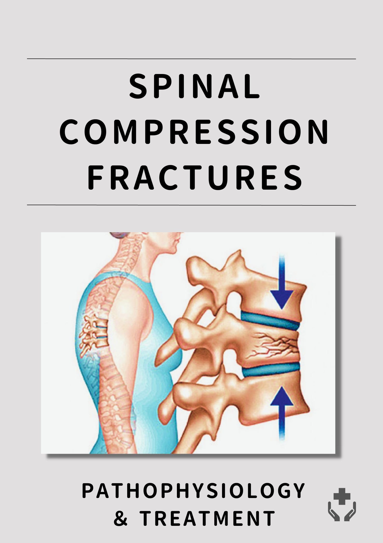 Spinal Compression Fractures Pathophysiology ＆ Treatment by Hiro