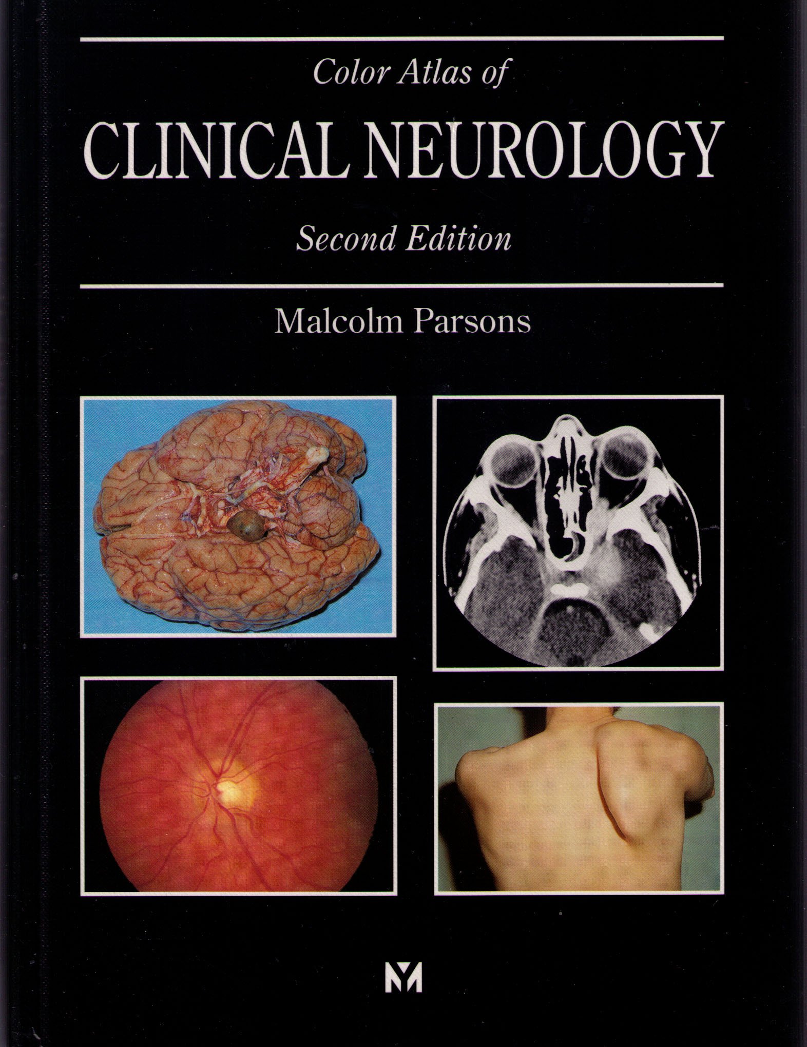 Color Atlas Of Clinical Neurology by Malcolm Parsons | Goodreads