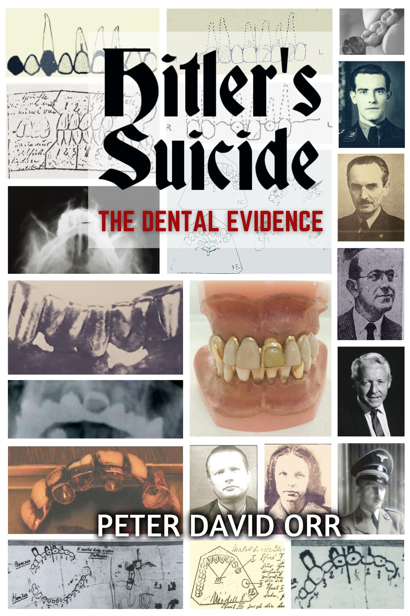 Hitler's Suicide The Dental Evidence by Peter David Orr Goodreads