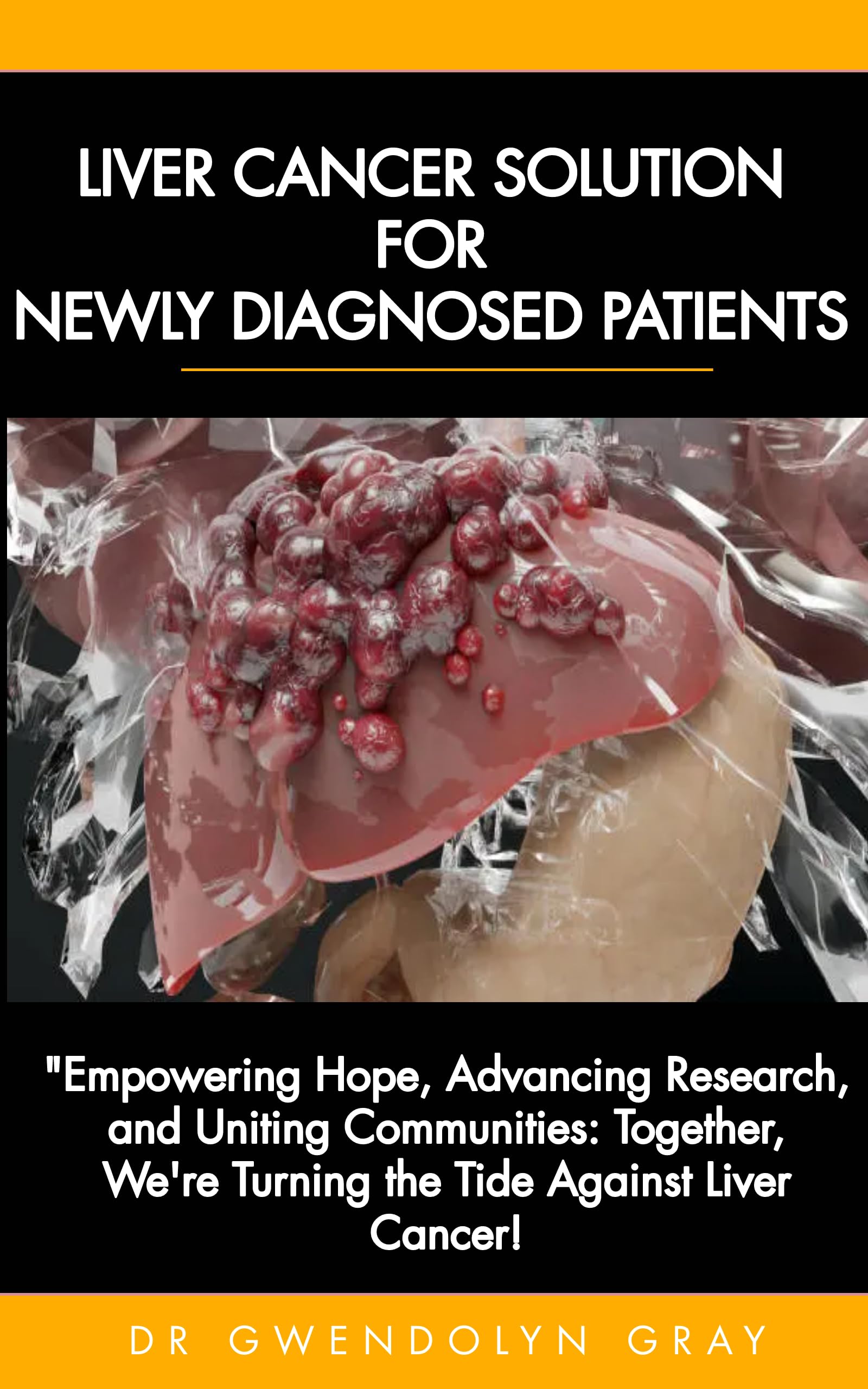 COMPREHENSIVE SOLUTION FOR NEWLY DIAGNOSED LIVER CANCER PATIENTS