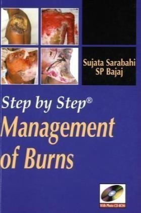 Step By Step Management of Burns